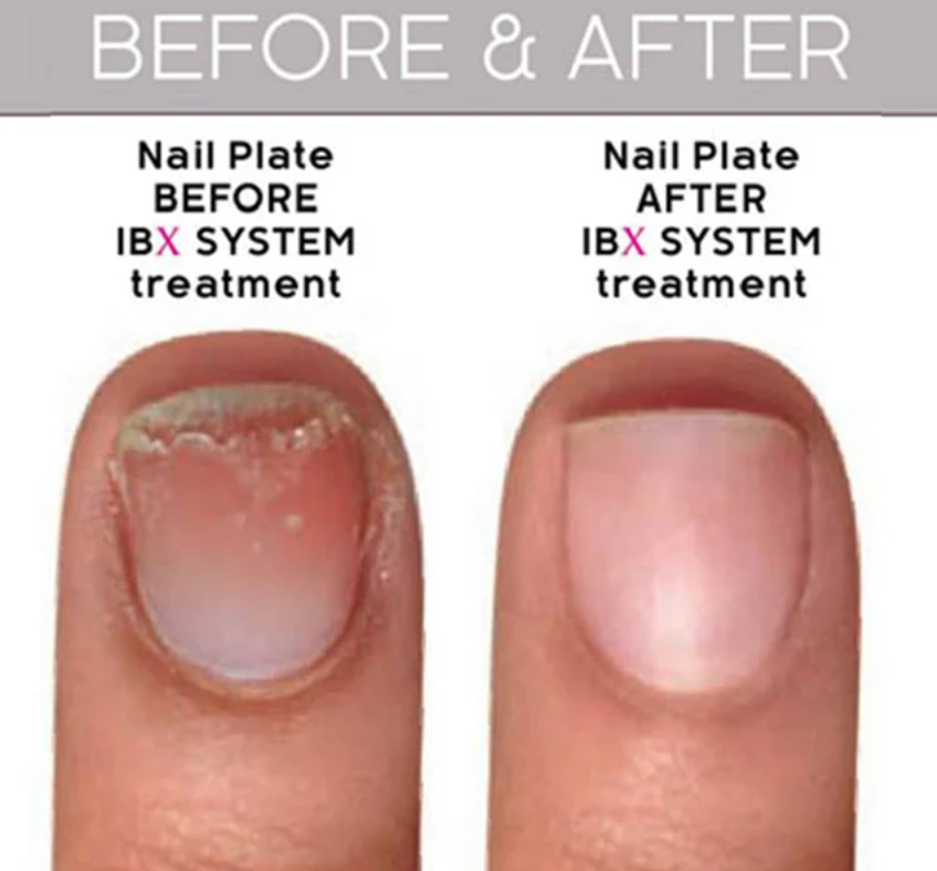 Is IBX Nail Treatment worth it?