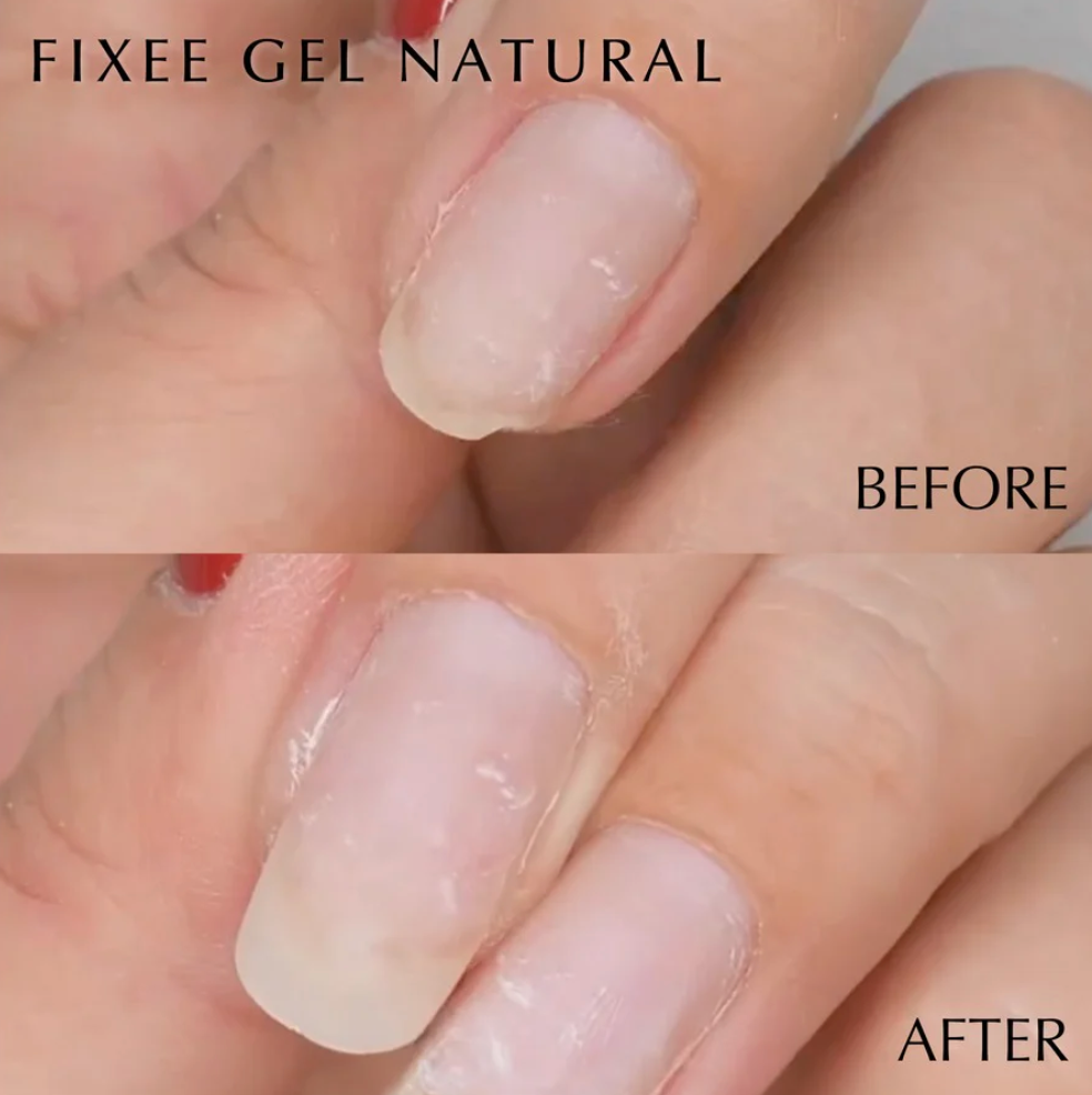 How do Nail Techs fix a split nail?